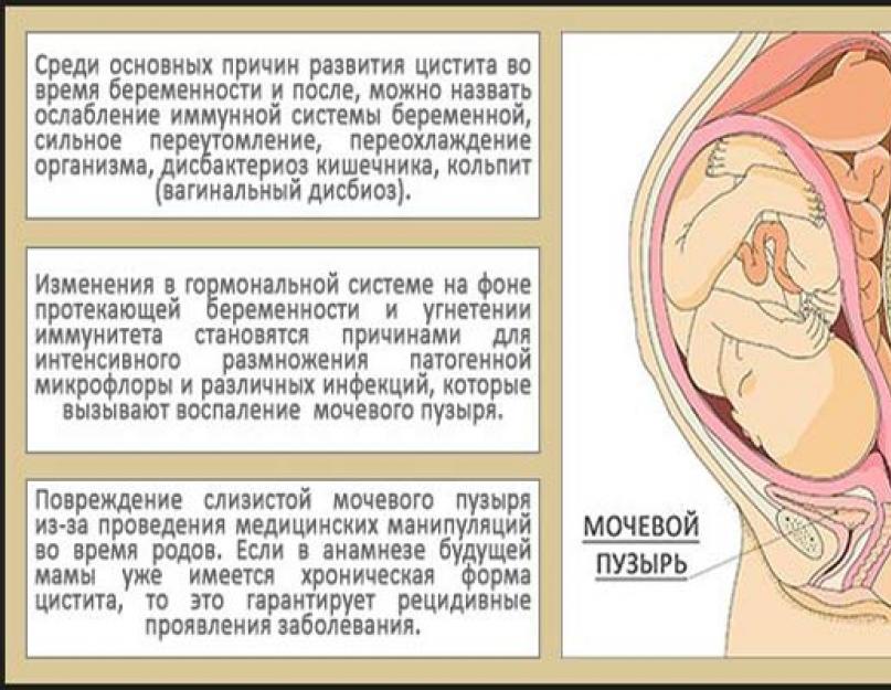 Болит живот при беременности: когда нужно быть тревогу. Болит живот при беременности: когда нужно быть тревогу Беременность 17 недель дергающие ощущения внизу живота