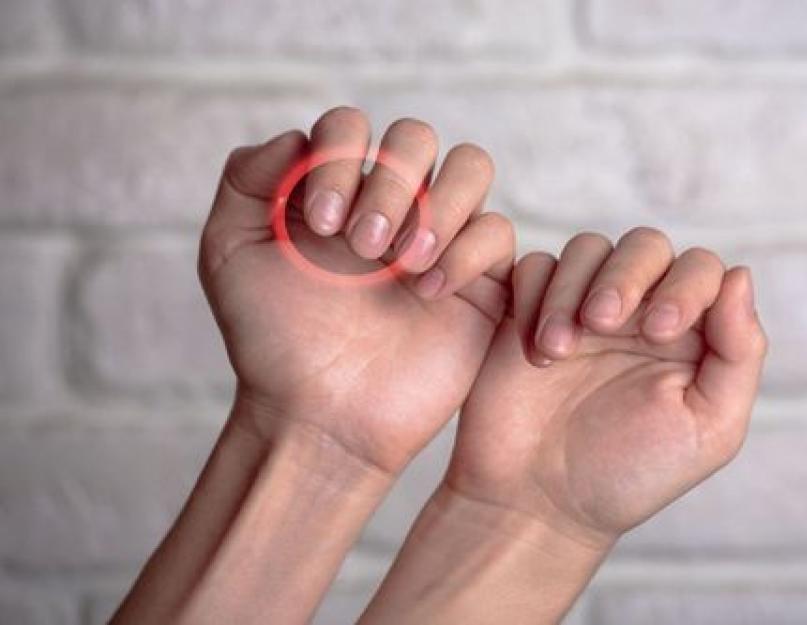 Почему на руках ногти пористые. Основные причины бугристых ногтей. Деформация ногтей: причины