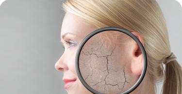 Причины шелушения кожи на лице у мужчин и женщин