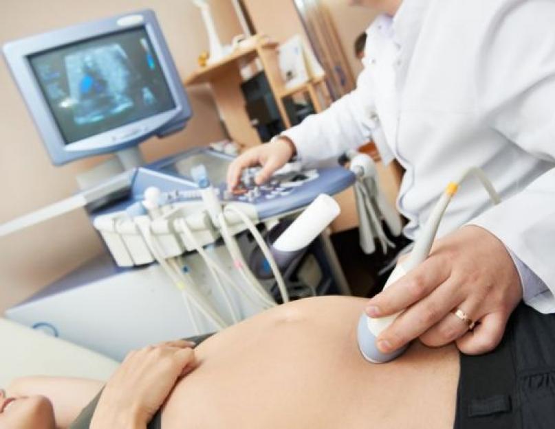 Скрининг первого триместра беременности — что нужно знать о нормах и результатах. Сколько по времени делается биохимический скрининг 1 скрининг сколько готовятся результаты