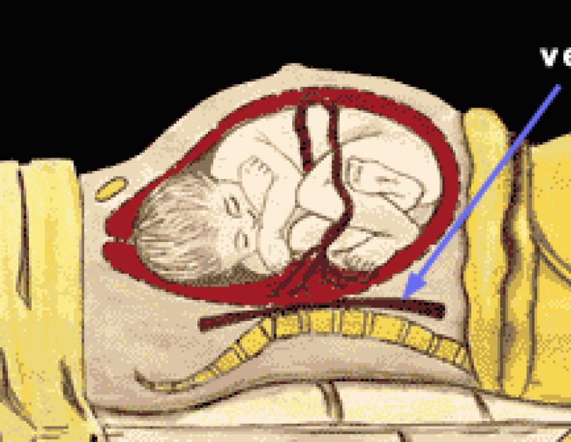 Почему беременным нельзя спать на спине во время беременности. Почему беременным нельзя лежать на спине? Можно ли спать на спине беременным