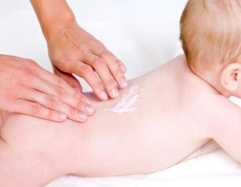 Come trattare la pelle dei neonati quando c'è arrossamento.  Come trattare una grave dermatite da pannolino in un neonato: i migliori prodotti per trattare la pelle del bambino a casa.  Tintura alcolica su germogli di betulla