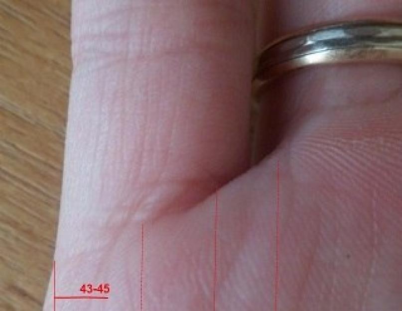 Káros-e az ujjak (és más ízületek) rendszeres ropogtatása?