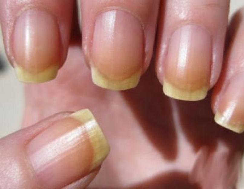 Stärka och bleka naglarna hemma.  Hur man bleker naglar hemma.  Citronsyrabad