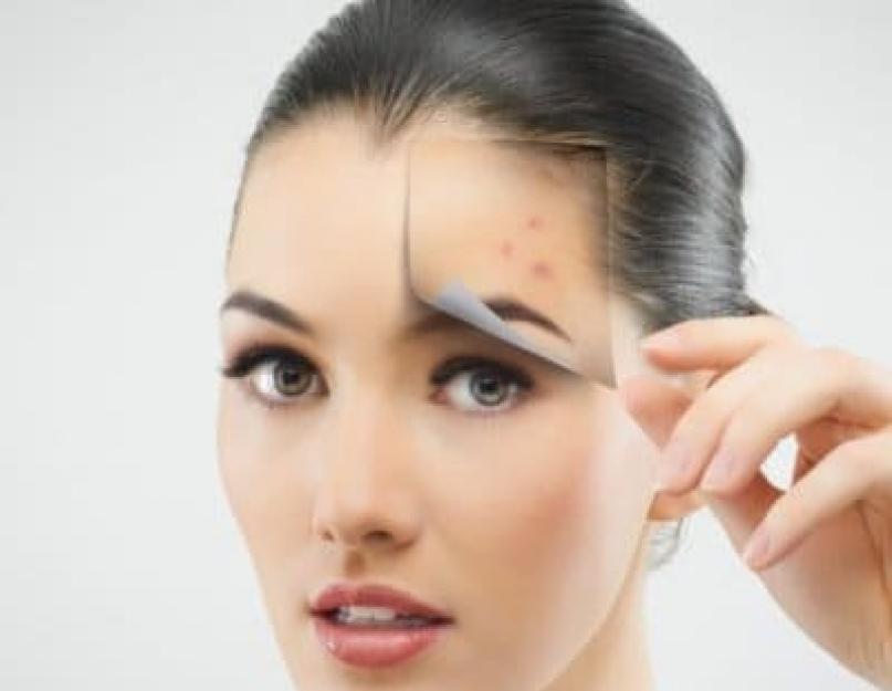 Pimple above the left eyebrow causes.  A sign is a pimple on the eyebrow: a man, a woman, a girl, a guy, a child, what to do.  Acne on the cheeks: causes and features of treatment