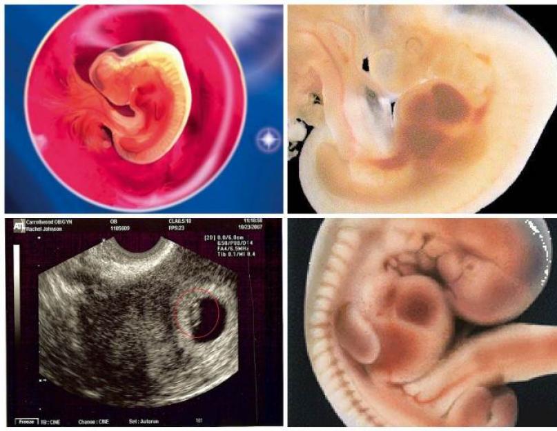 Pirmųjų 5 nėštumo savaičių pojūčiai.  Embriono vystymasis dienomis ir savaitėmis.  Vaiko vystymasis paskutinėmis nėštumo savaitėmis